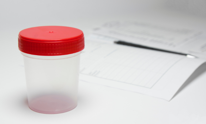 What foods should you avoid before a urine drug test?